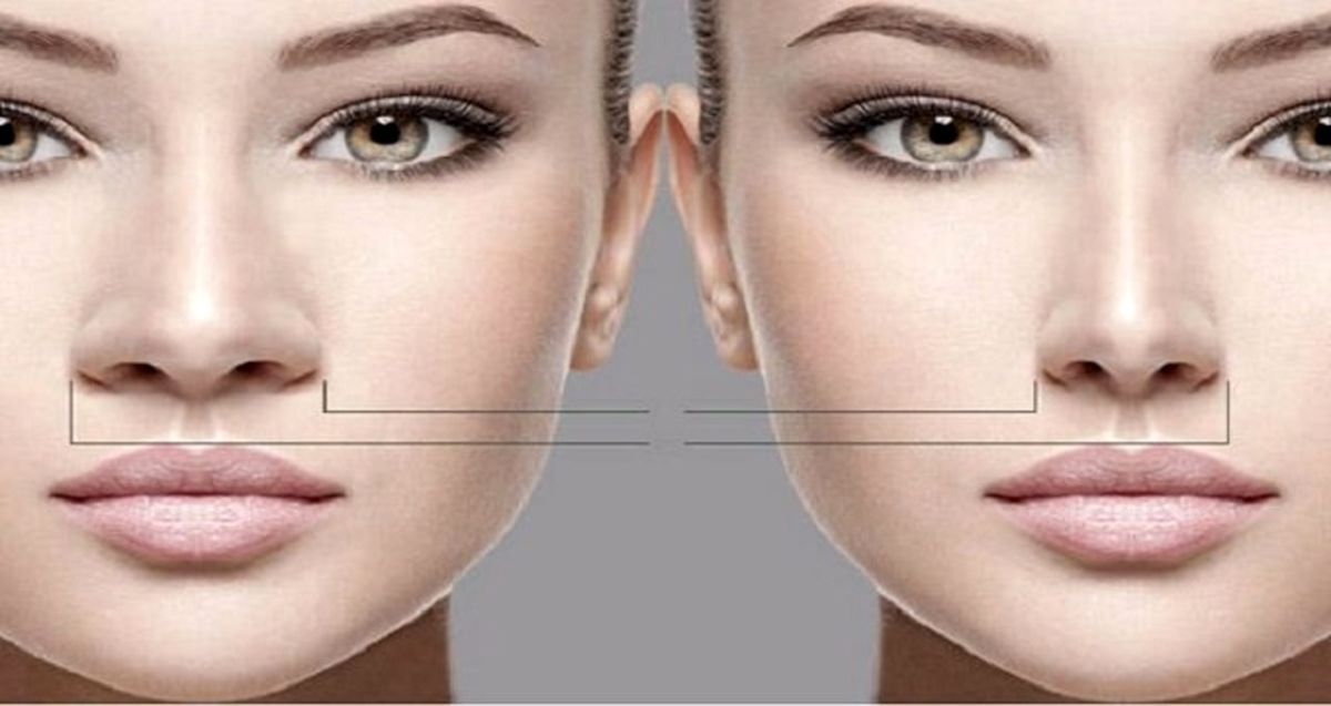 معرفی بهترین جراح بینی گوشتی، استخوانی و پروتز سینه در تهران