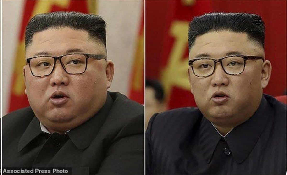 لاغری عجیب کیم جونگ اون +عکس