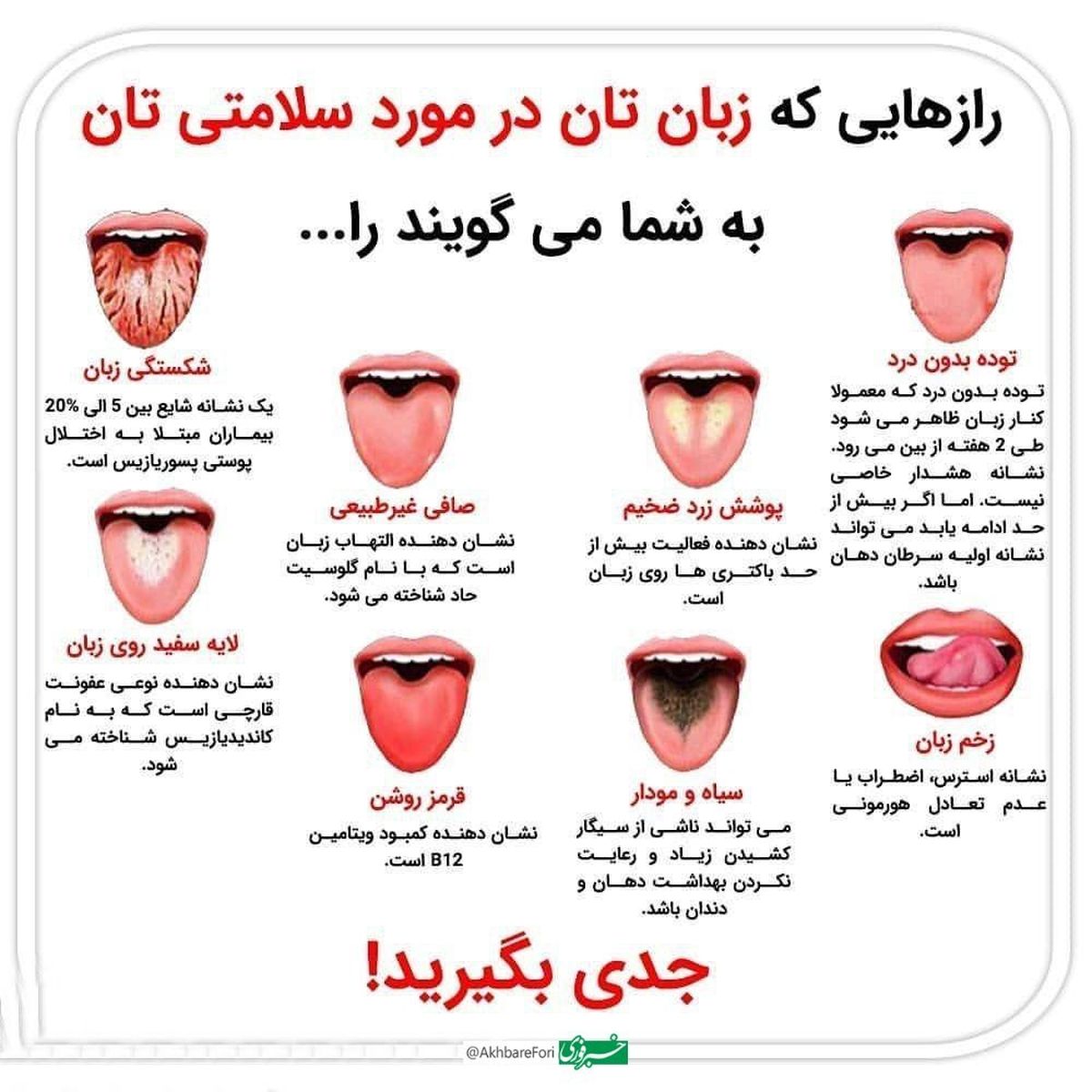 زبانتان می‌تواند یک عـالمه راز درباره سلامتیـتون لو بـدهد!