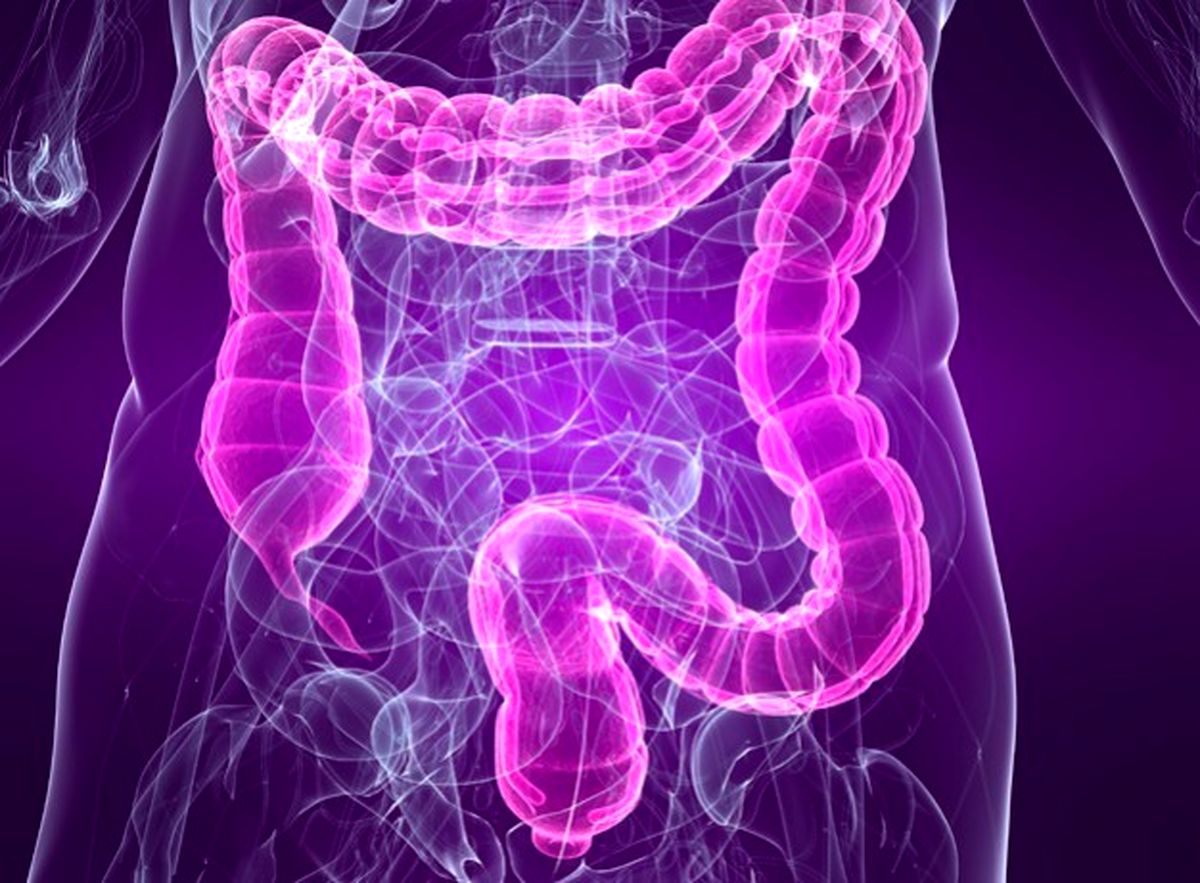 عاداتی که باعث ابتلا به سرطان روده بزرگ می‌شود