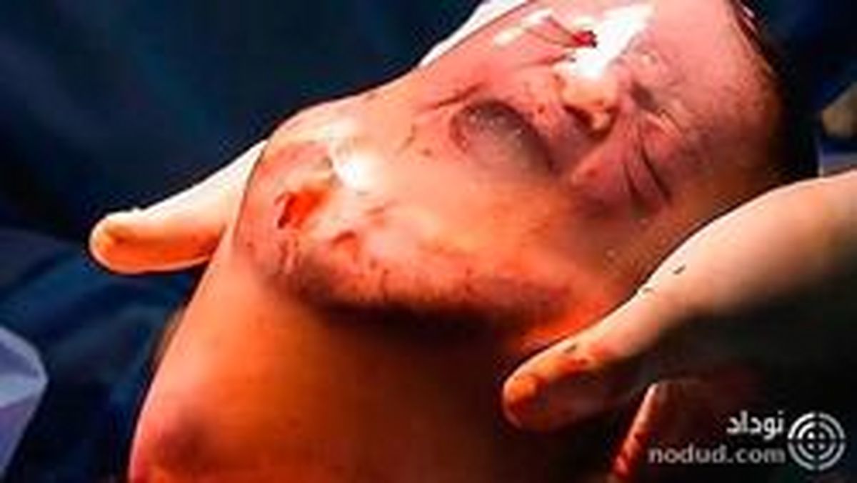 اولین تصاویر از نوزادی که داخل یک کیسه آب به دنیا آمد!