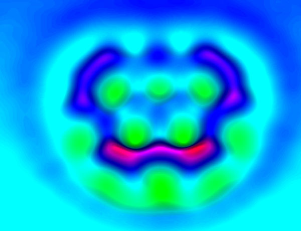 ریزترین حلقه المپیک جهان/ عکس