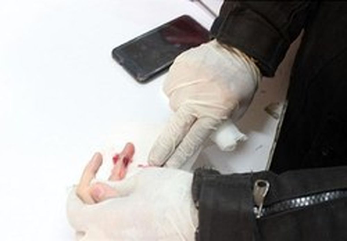 دست زن جوان در دستگاه دگمه‌زنی قفل شد +تصاویر