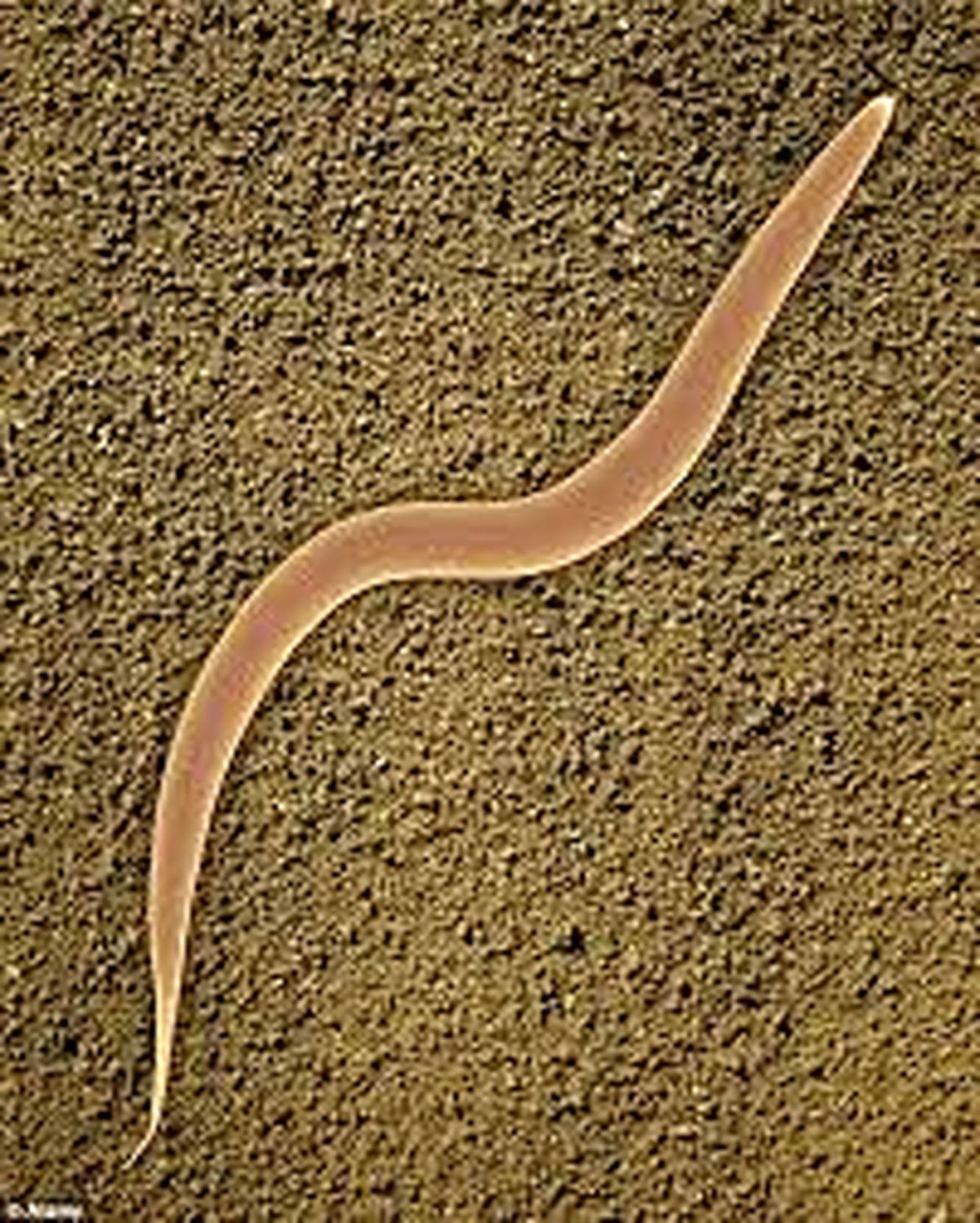 شیوه‌‎باورنکردنی‎برای‎ازبین‎بردن‎چربی‌ها/عکس