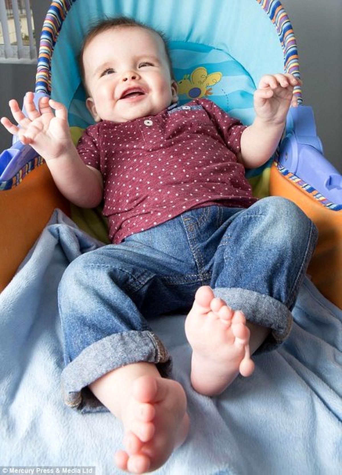 این نوزاد ۱۲ انگشت دست و پا دارد/عکس