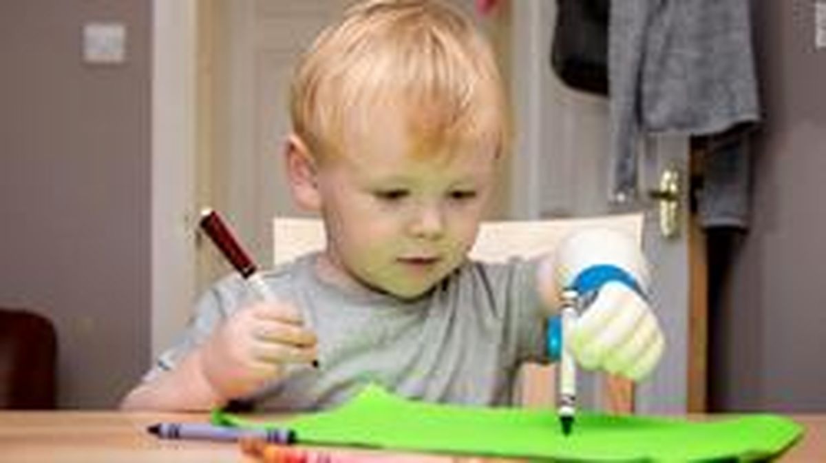 پدر مهربان برای فرزندش بازوی پروتز ساخت +تصاویر