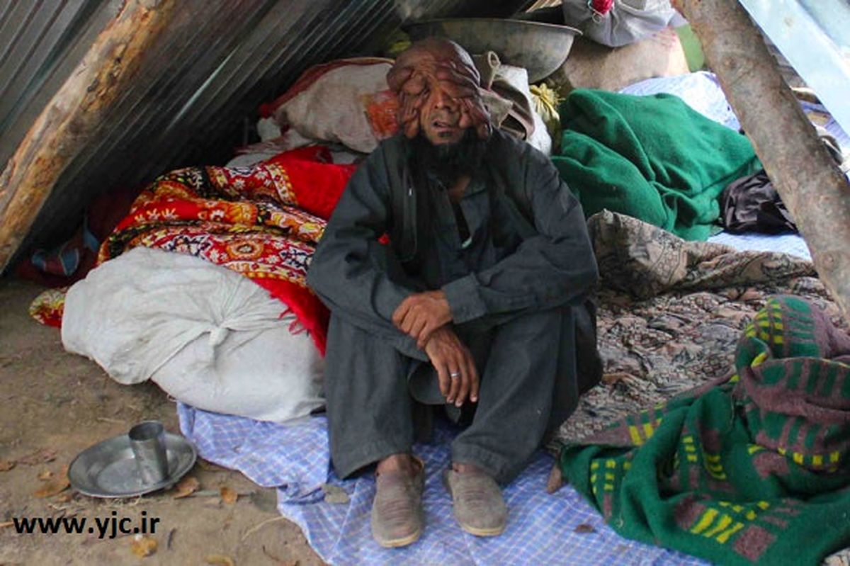 کشف مرد بدون صورت/ تصاویر