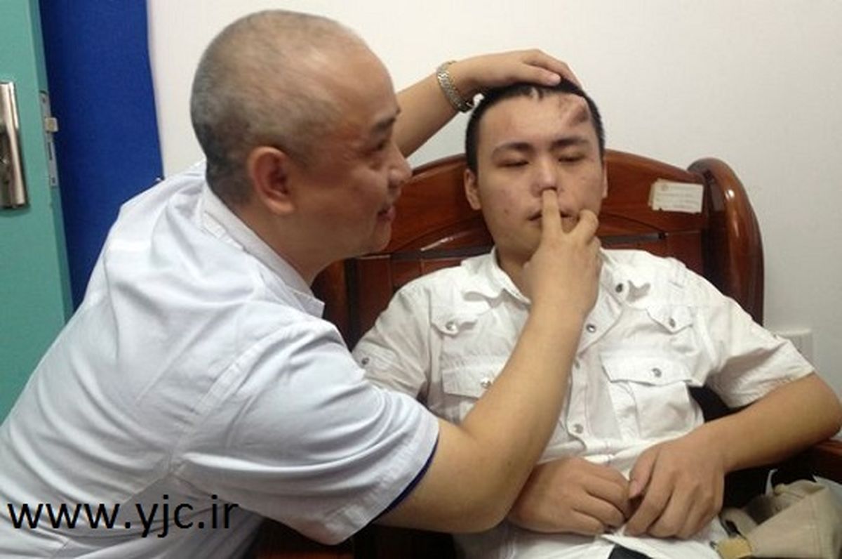 رشدبینی روی پیشانی مرد چینی!/تصاویر