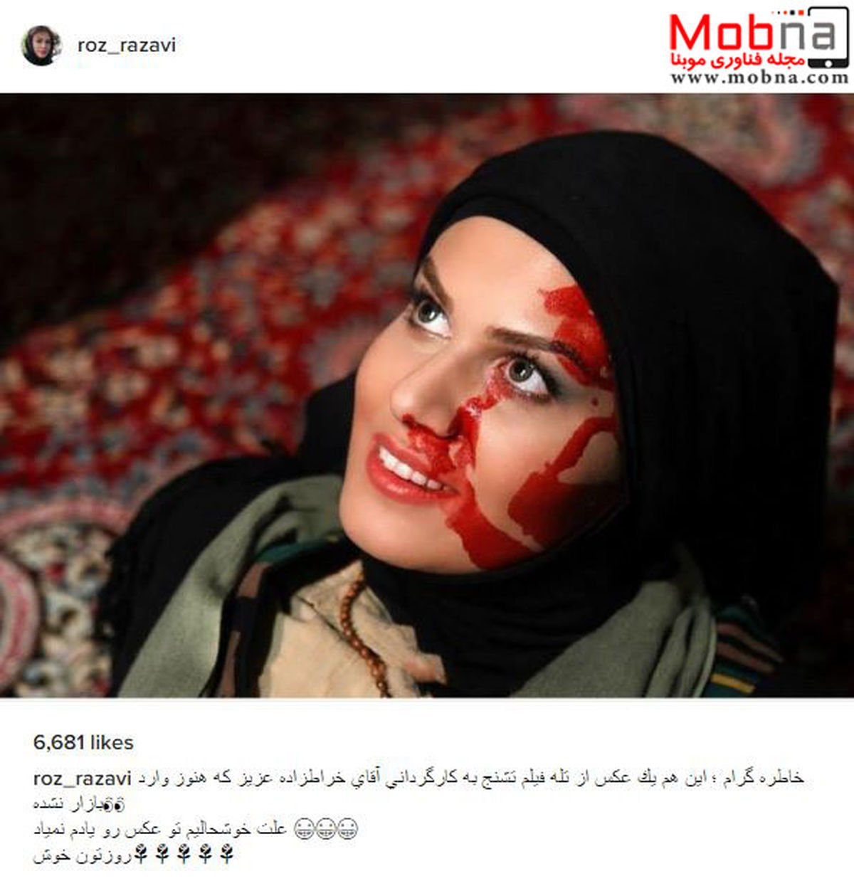 عکس: رز رضوی با صورت خون آلود