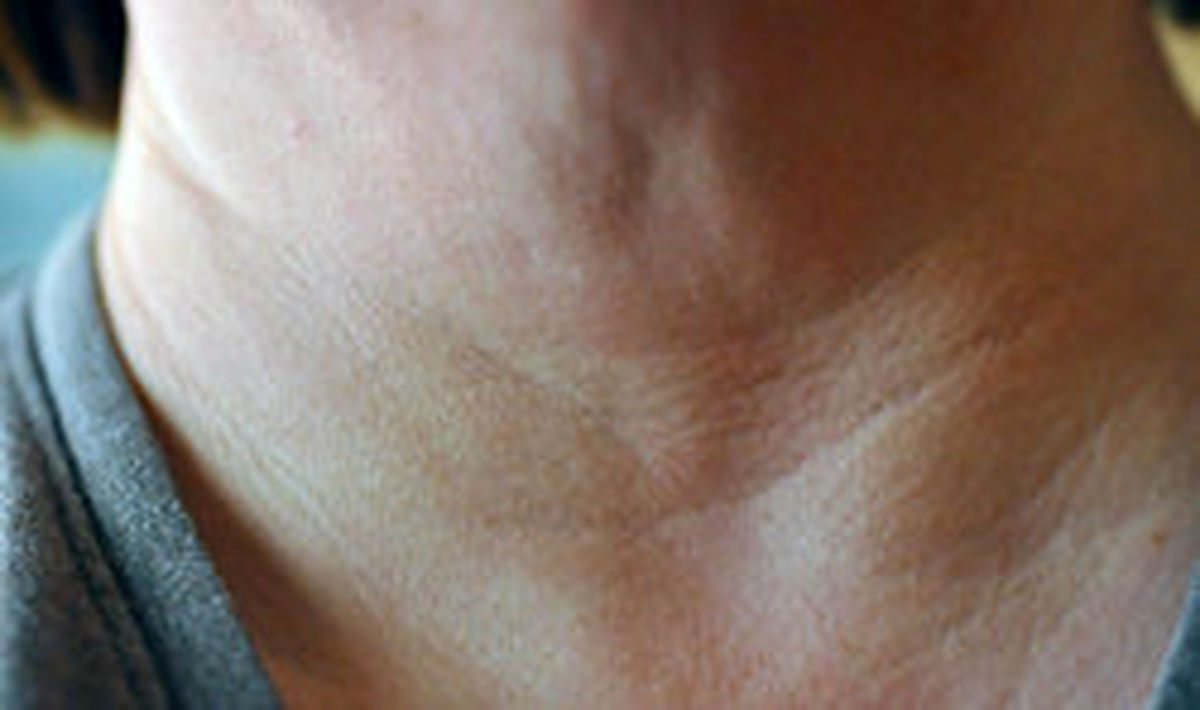 
۶ توصیه متخصص پوست برای مراقبت از گردن