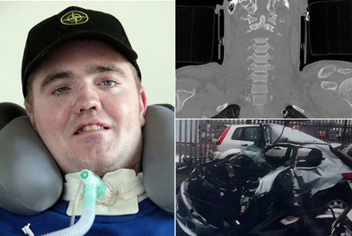 زنده‎ماندن مردی که‎سرش قطع‎شد!/عکس