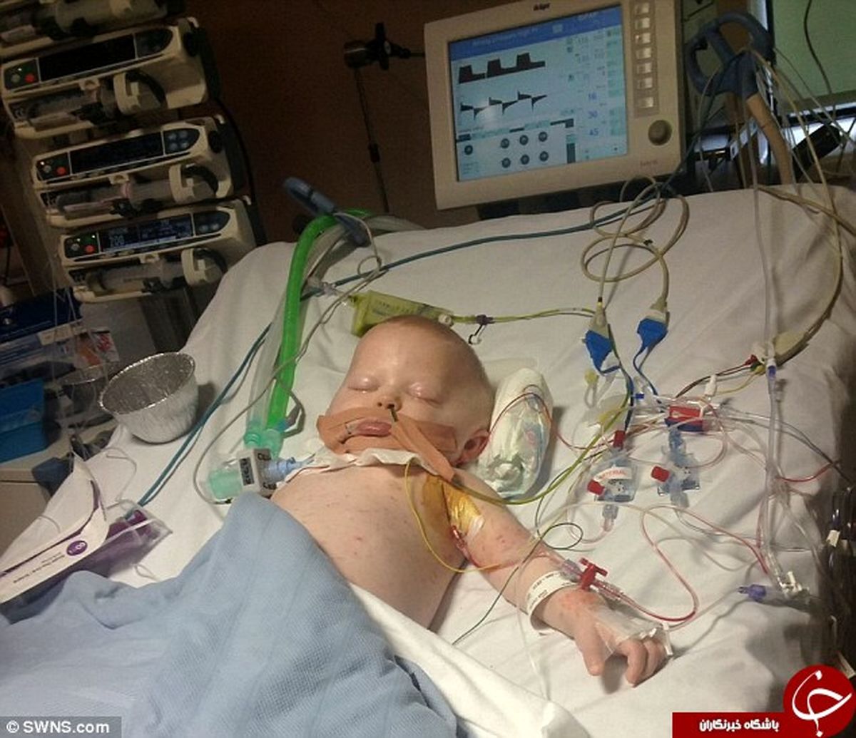 باکتری گوشتخوار گردن این کودک را زنده زنده خورد +تصاویر(18+)