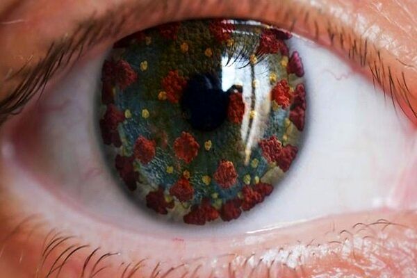 علایم کرونای چشمی را جدی بگیرید