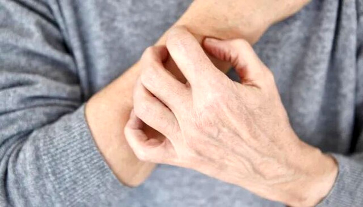 خارش بی‌دلیل پوست را جدی بگیرید