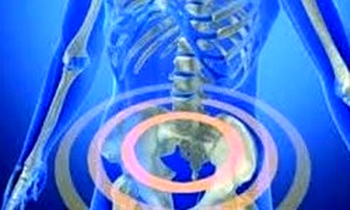 «آندومتریوز» خطری که زنان را تهدید می‌کند