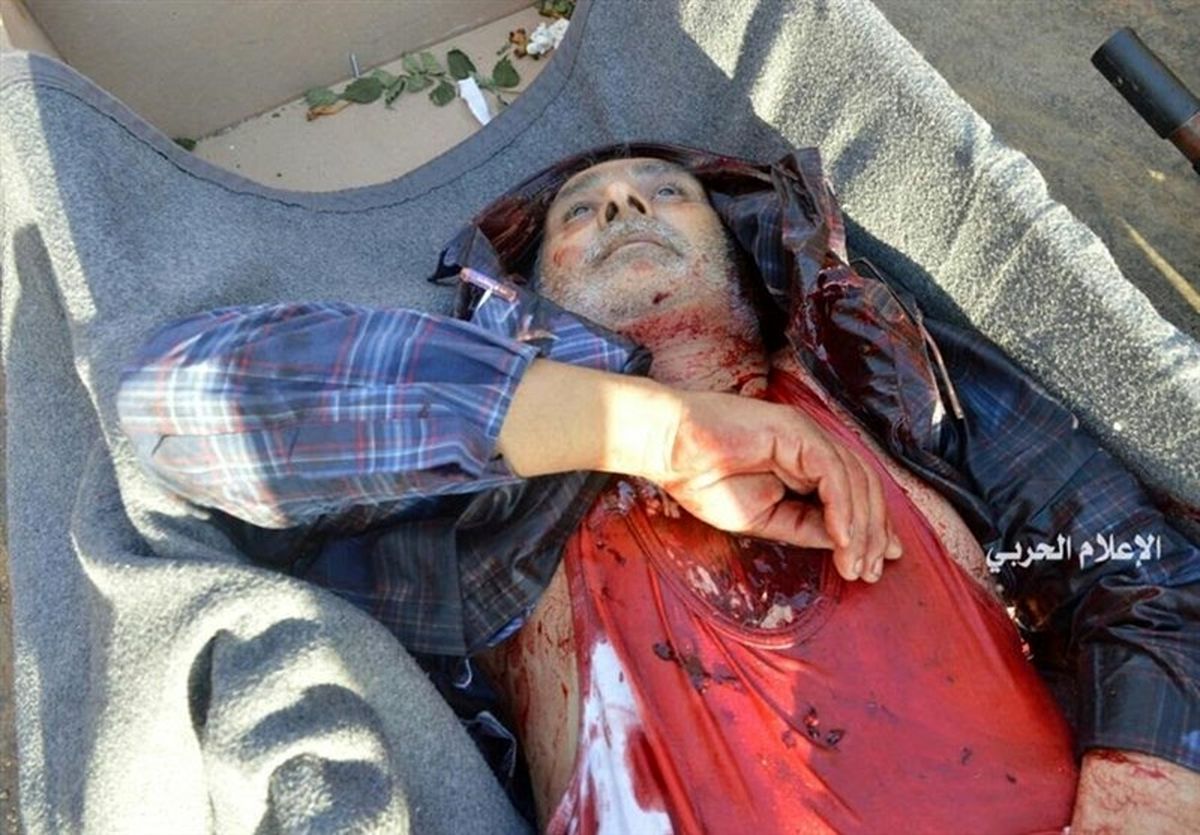 تصاویر دلخراش حمله تروریستها به حومه حلب