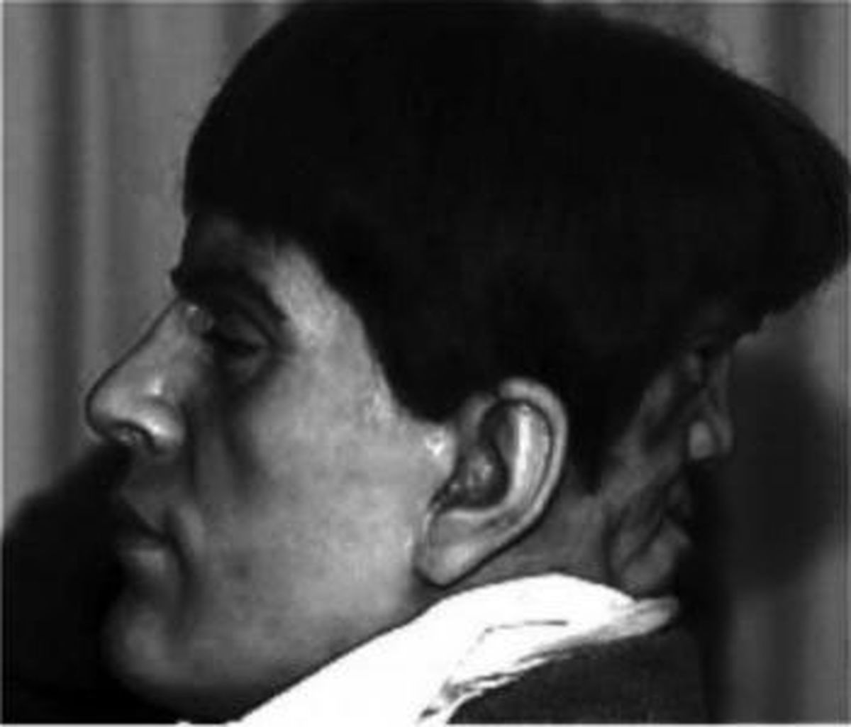 داستانشگفتانگیزمردیکهدوصورتداشت/عکس