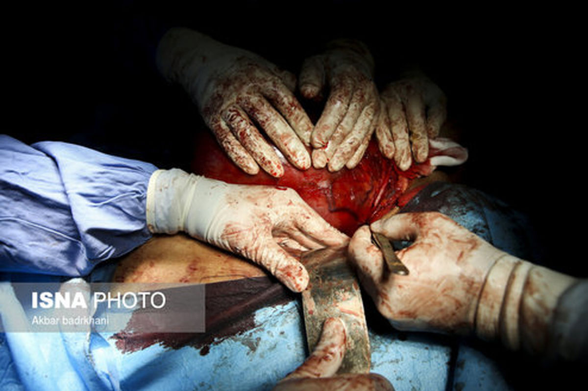 تصاویر: جراحی تومور لگن (این گزارش حاوی تصاویر دلخراش است)