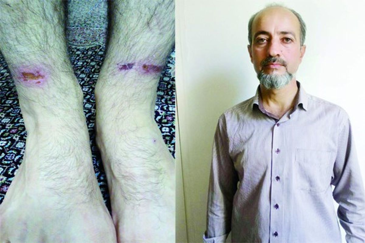 فرار گروگان ۸۰۰ میلیونی از اسارتگاه مخوف